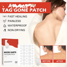 Skin Tag and Mole Remover Patch