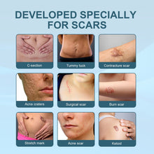 Scar Spray - Cure All Type of Scars