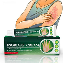 Psoriasis Cream